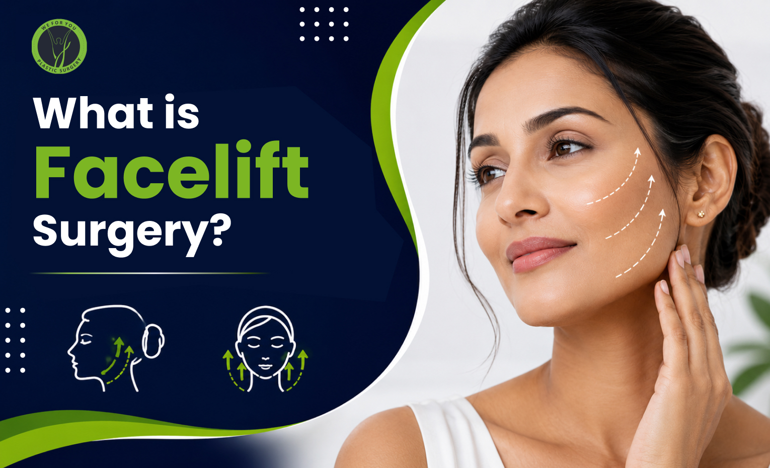 What Is Facelift Surgery? A Calm, Clear Guide Before You Decide