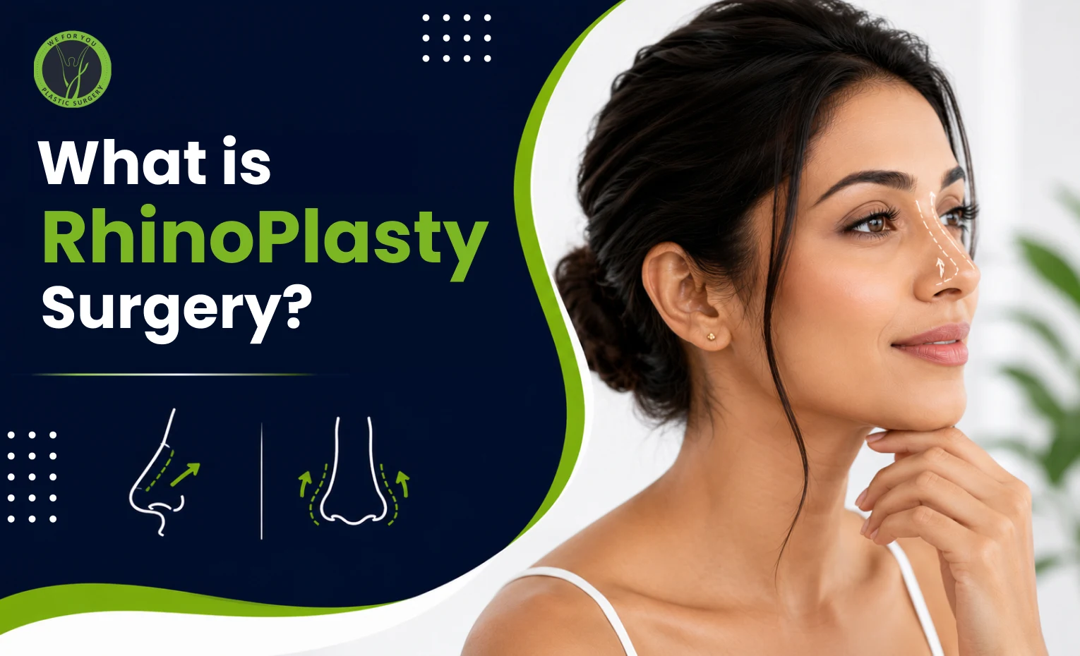 What Is Rhinoplasty Surgery? A Simple, Honest Guide Before You Decide